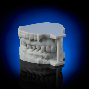 Whip Mix VeriModel OS Grey Dental Model 3D Print Resin