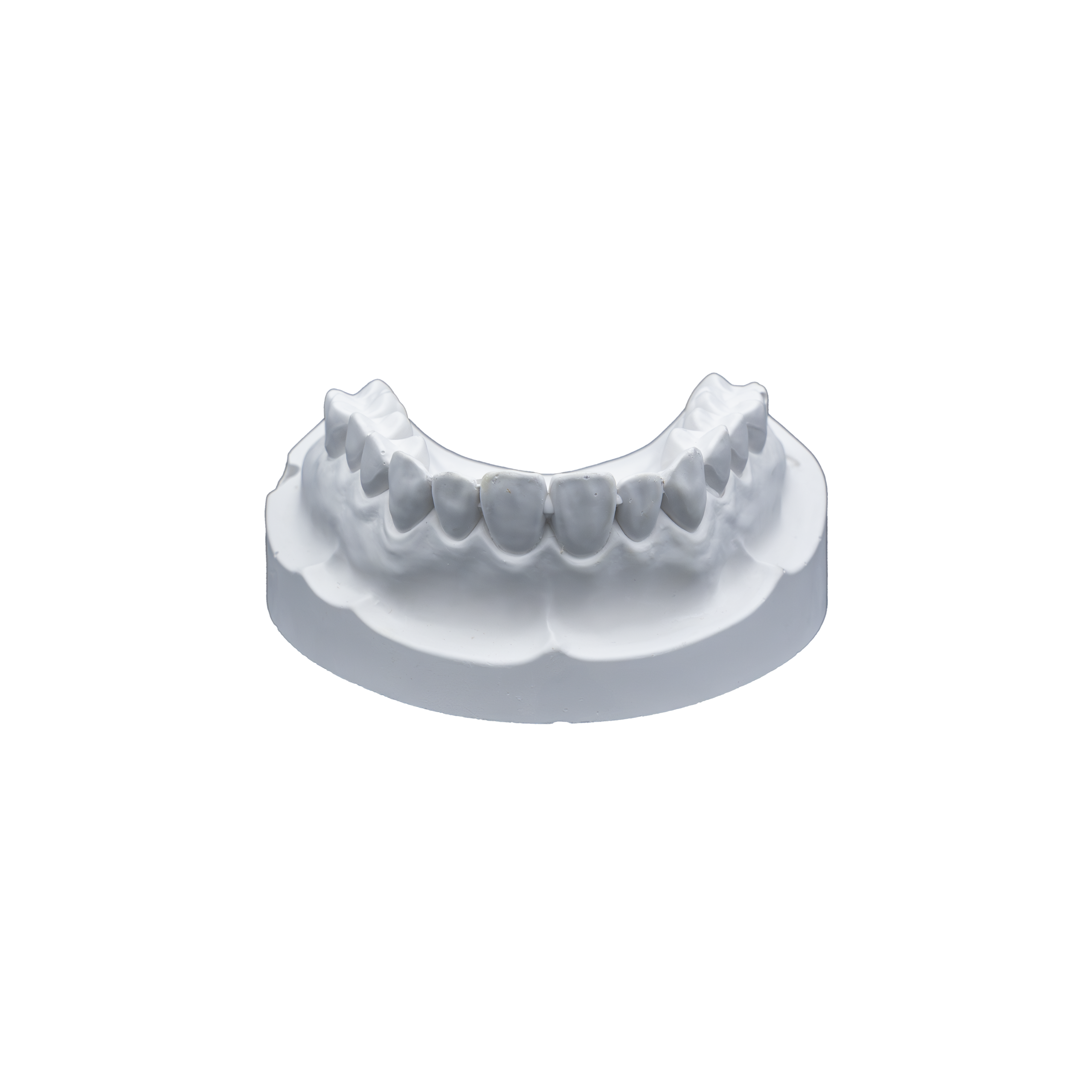 Orthodontic Stone