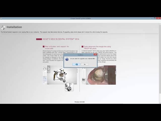 3Shape Tutorial - Upgrading the 3Shape Software | Whip Mix