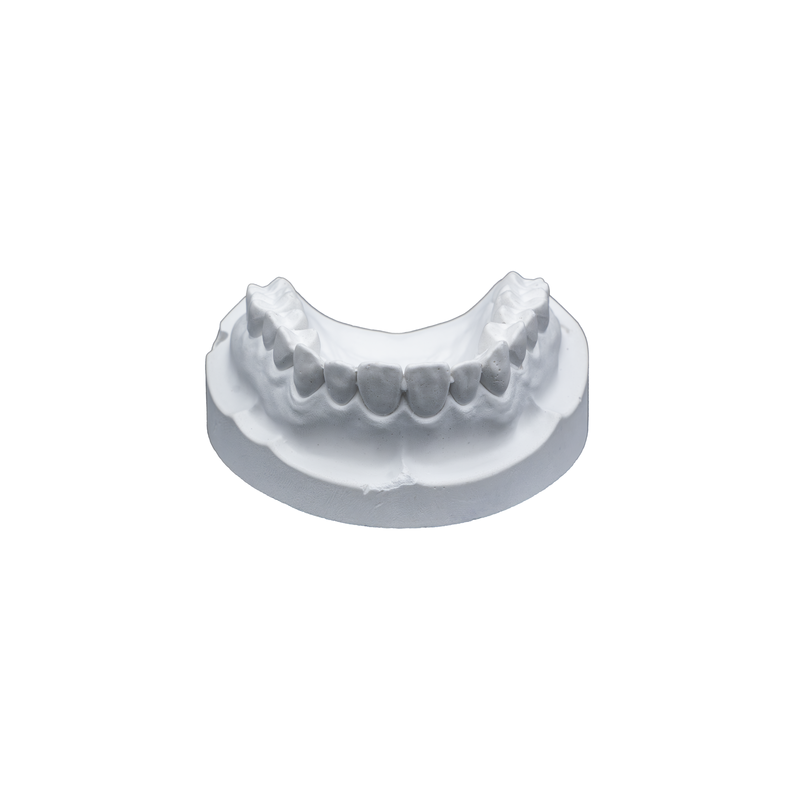 Mounting Plaster