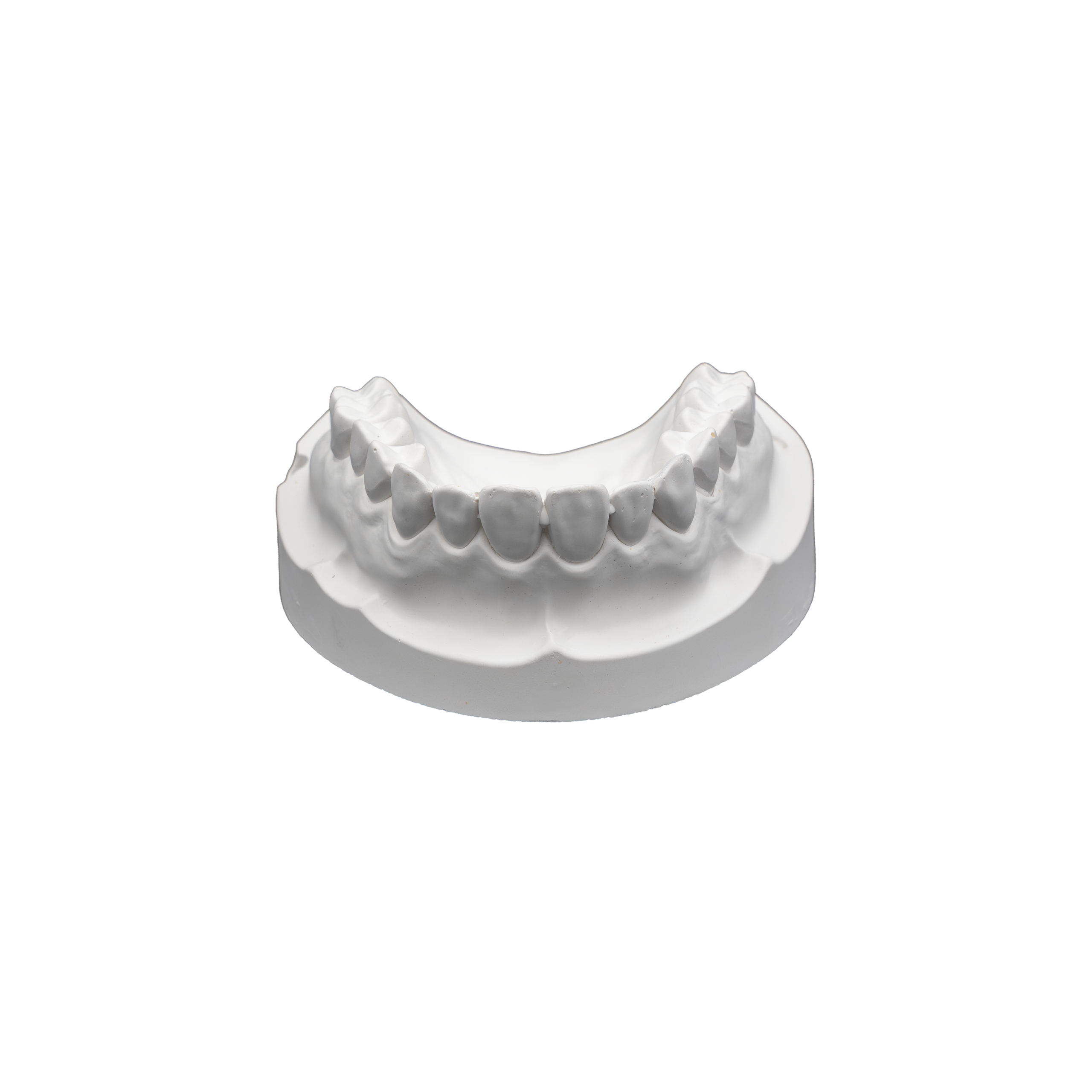 Orthodontic Plaster